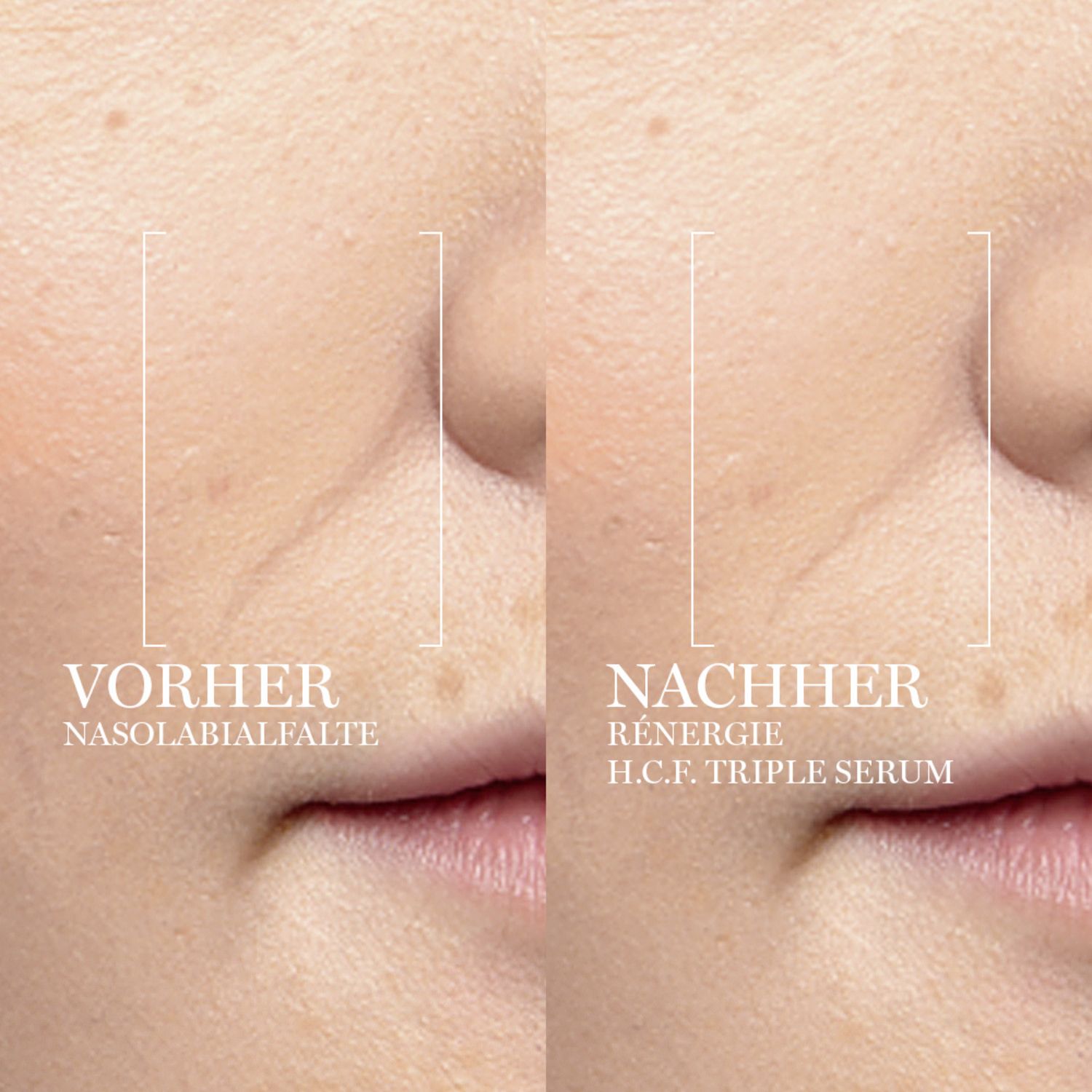 Rénergie H.C.F. Triple Serum