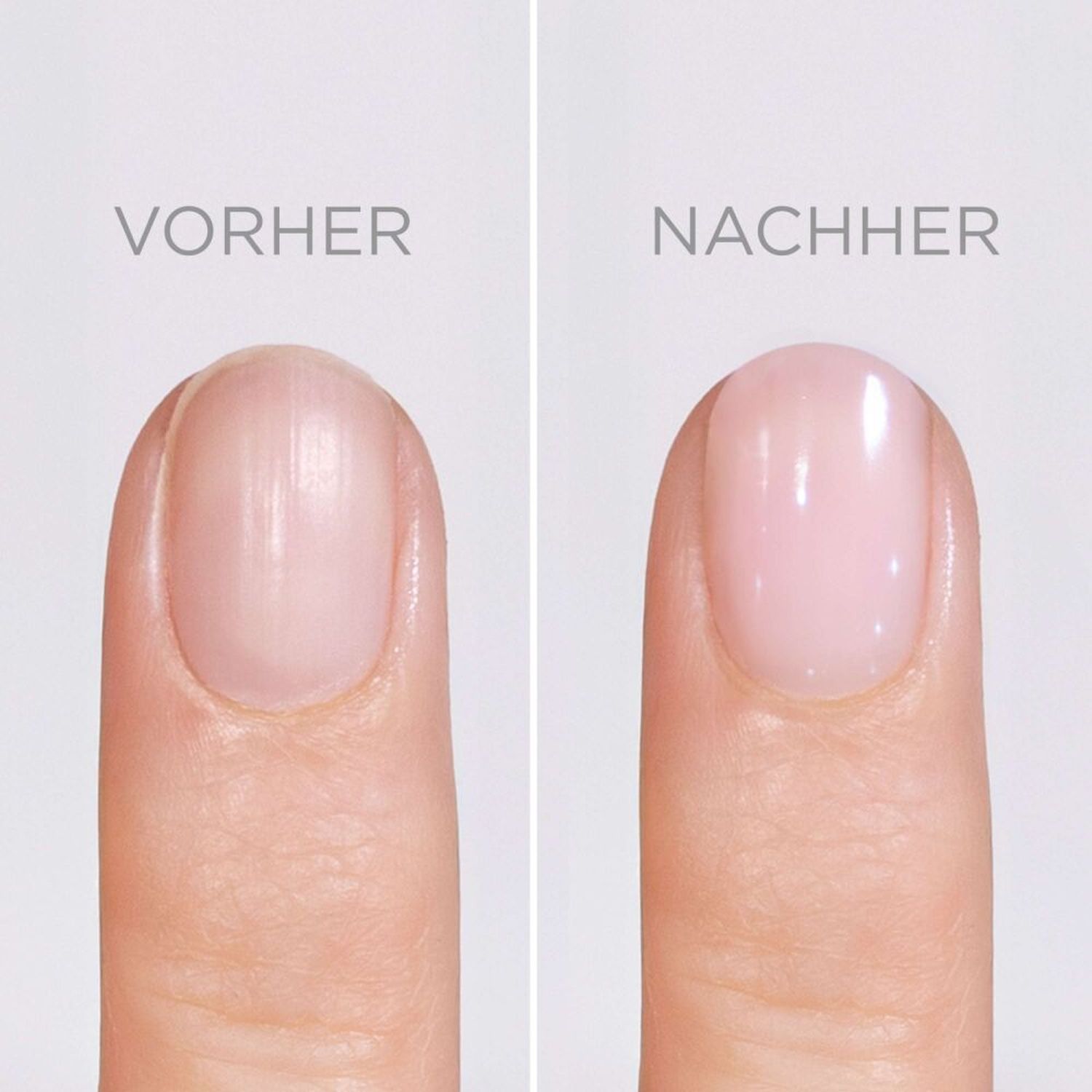 SOS Nail Repair