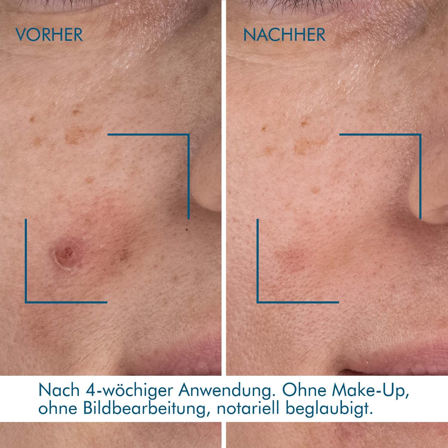 Blue Retinol Serum Night