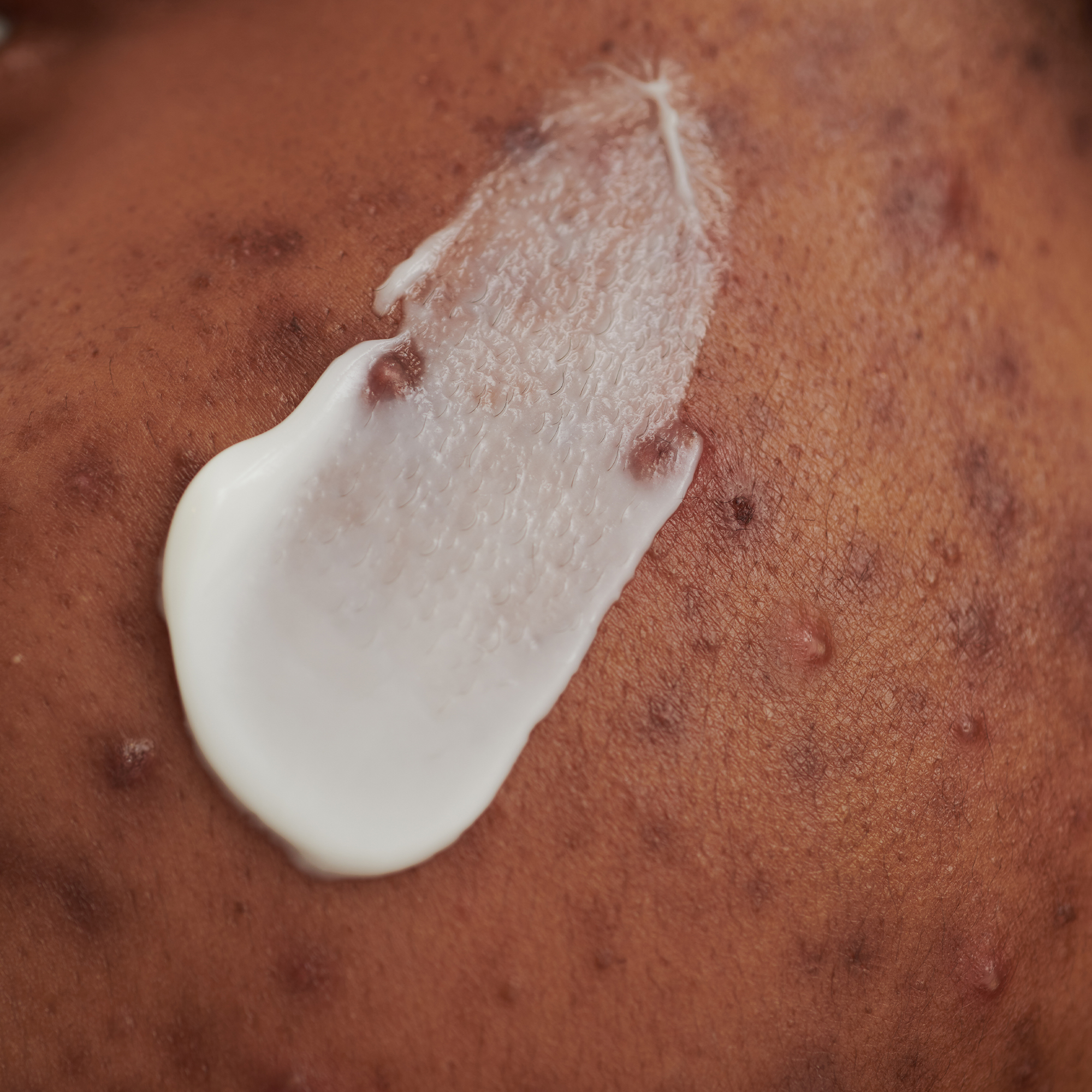 PURDERM EFFEKTCREME