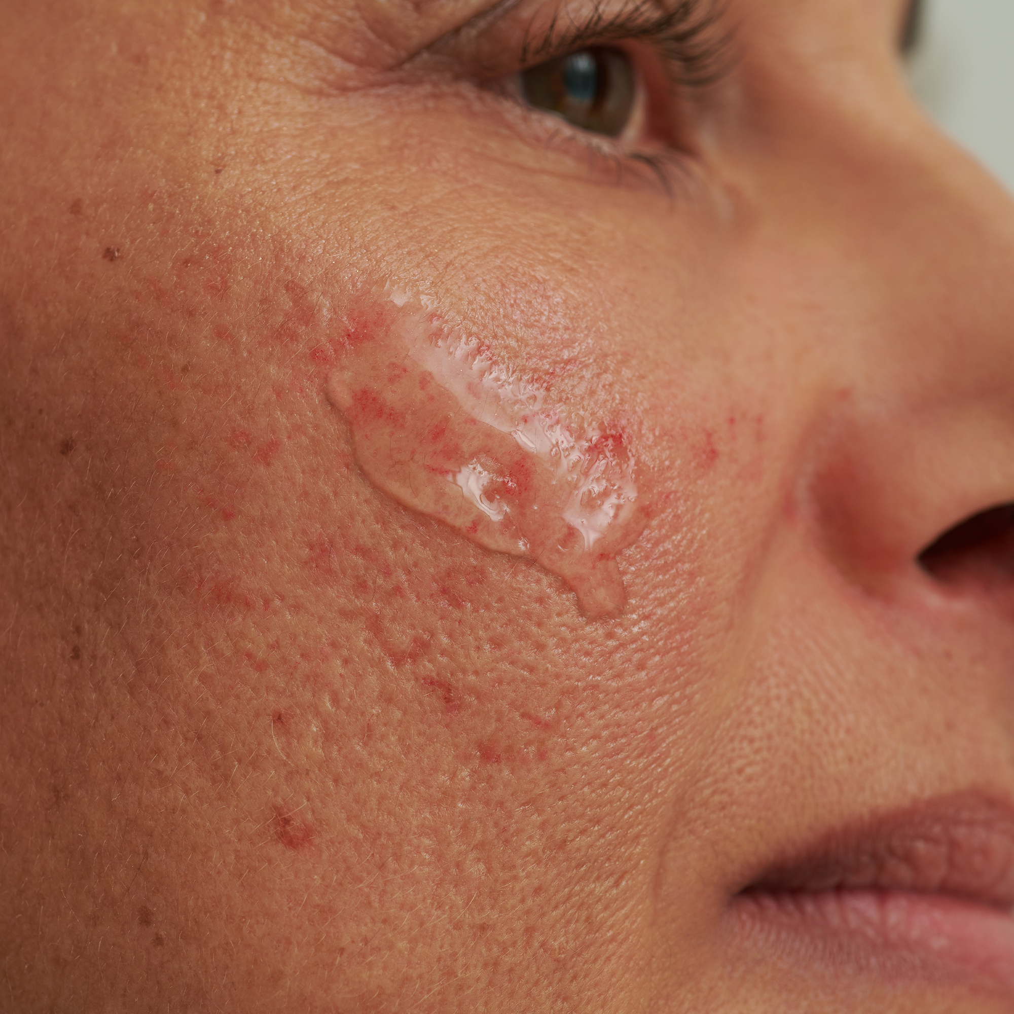 SENSACEA INTENSIVSERUM