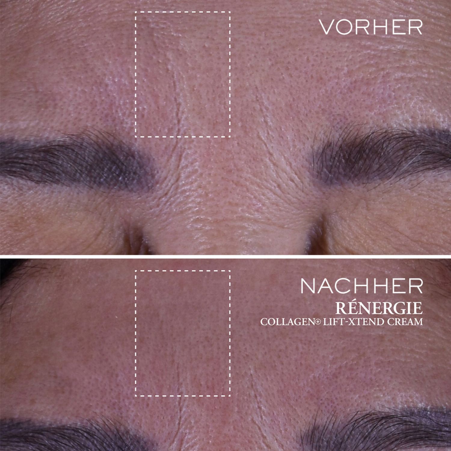 Rénergie Collagen Lift-Xtend Cream